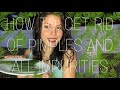 HOW TO: GET RID OF PIMPLES, SCARS, BURNS, AND ALL IMPURITIES! | ALOE VERA NUTRIENTS | HELLEN GOMEZ