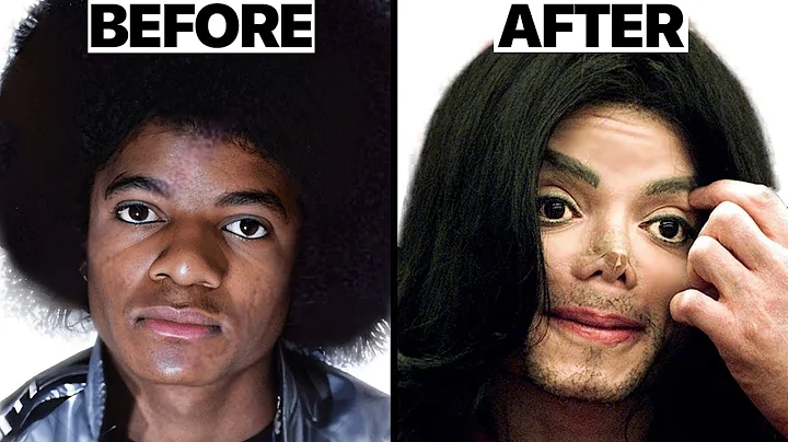 Michael Jackson Nose Job Plastic Surgeries - Surgeon Reacts - DayDayNews