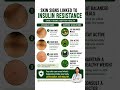 Skin Signs of Insulin Resistance You Shouldn’t Ignore ⚠️