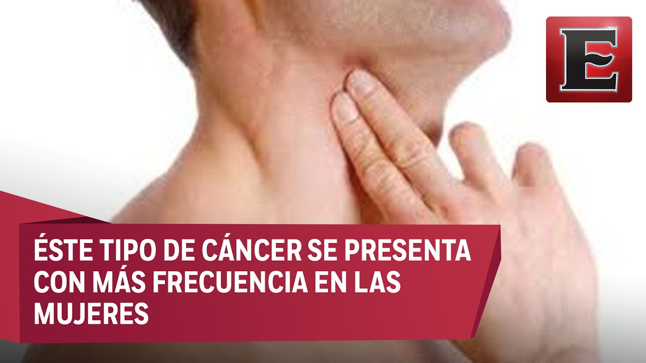 Cáncer de garganta esperanza de vida