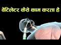 वेंटिलेटर क्या है और ये कैसे काम करता हैं - ventilator in hindi