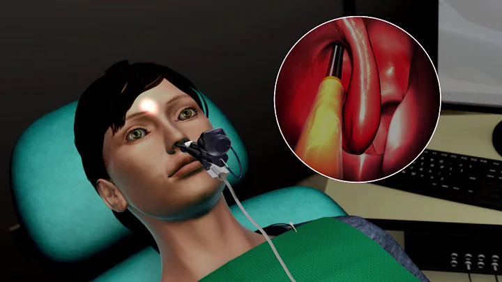 Balloon Sinus Surgery Animation