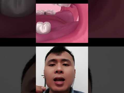 Video: 4 Cara Membersihkan Gigi Secara Semulajadi