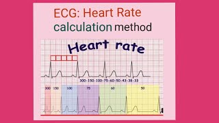 ECG Heart Rate Calculation in Hindi
