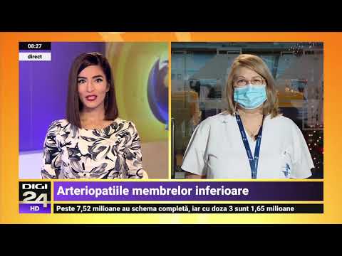 Angioplastia de membru inferior – Dr. Rodica Niculescu | Spitalul Clinic SANADOR