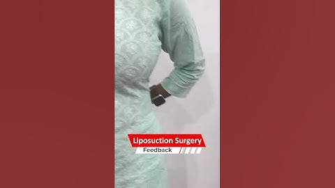 Liposuction result | Liposuction Feedback 360 Abdominal Liposuction #short #Short #shortvideo #share