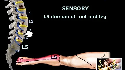 Neurological Evaluation Of The Lumbar Nerve Roots - Everything You Need To Know - Dr. Nabil Ebraheim