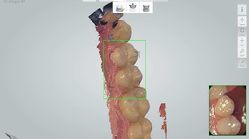 TRIOS® - Fast & Easy