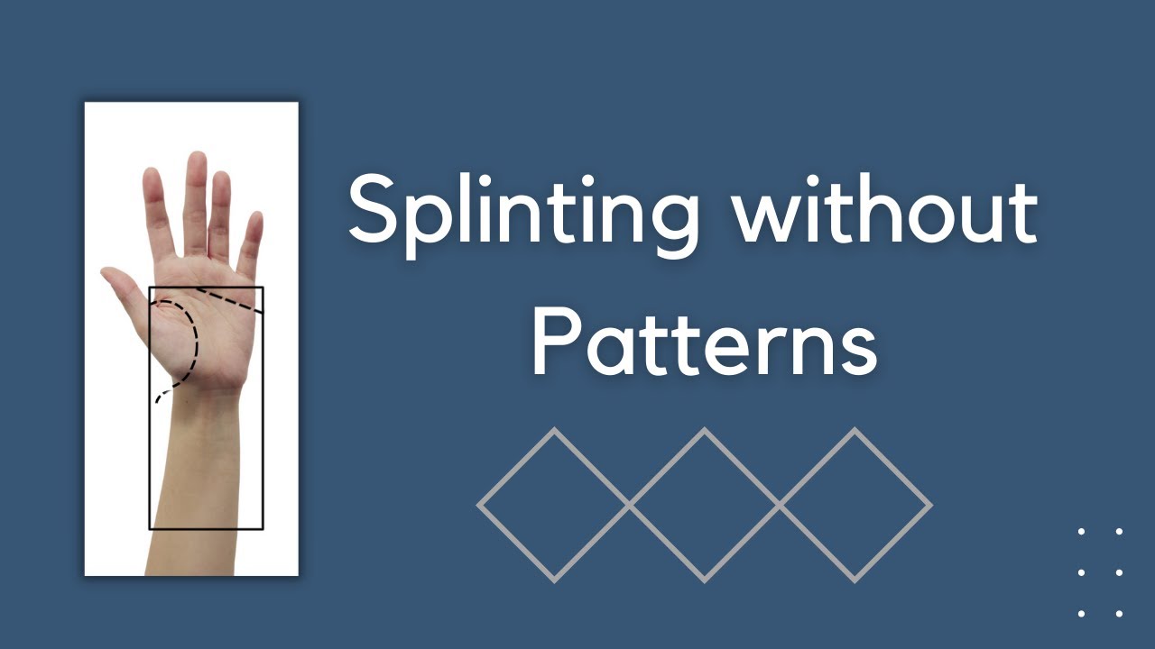 How to splint without patterns - Hand Therapy - YouTube