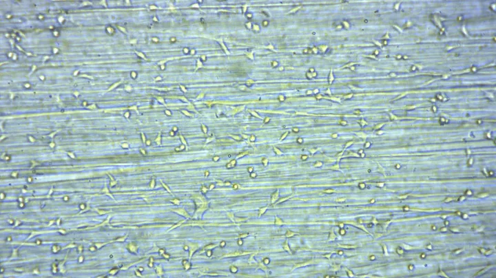 EzScope Application - Epithelial Cells of Lung Adenocarcinoma(A549) │Blue-Ray Biotech