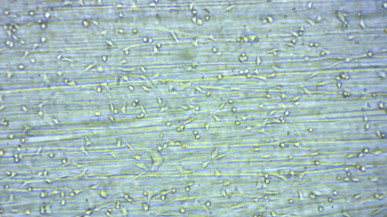 EzScope Application - Epithelial Cells of Lung Adenocarcinoma(A549) │Blue-Ray Biotech