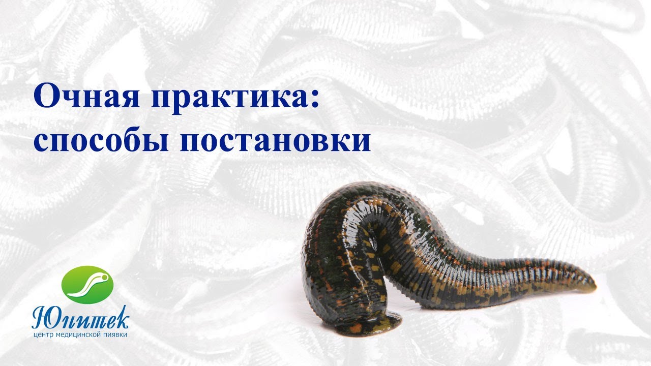 Способы постановки пиявок. Как правильно ставить пиявок?