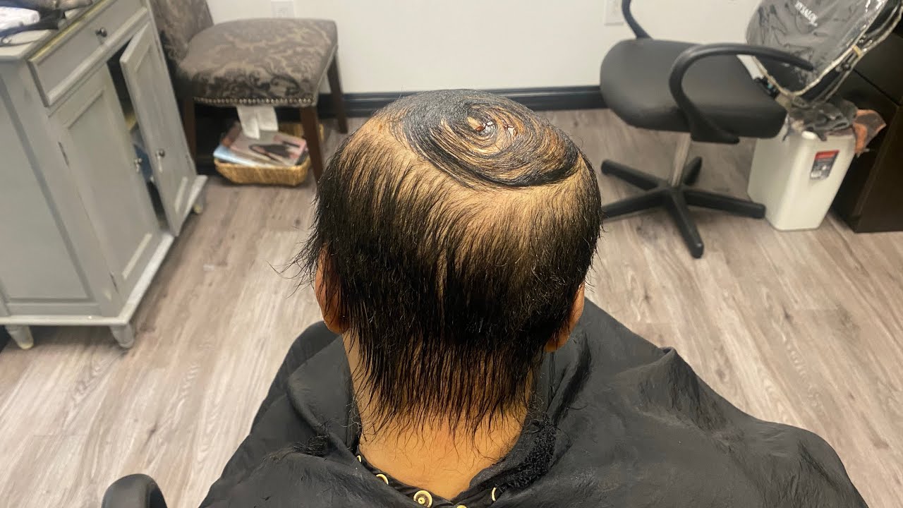 Alopecia Weaving How to cover a large bald spot YouTube