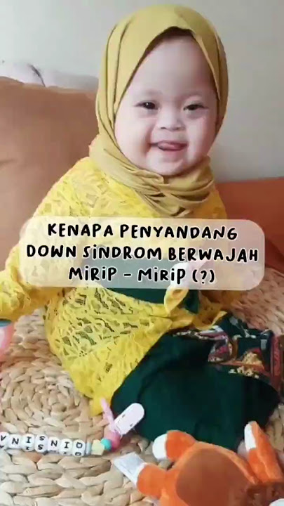 KENAPA ANAK DENGAN DOWN SYNDROME MIRIP-MIRIP ? #shorts #shortsvideo #withloveqinsi #downsyndrome