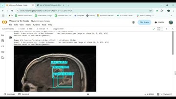 Project - Brain Tumor Segmentation with YOLO 11 and SAM2