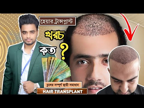 ভিডিও: হেয়ার প্লাগ কোথা থেকে আসে?