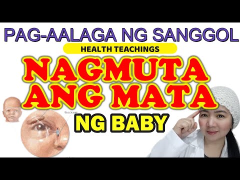 Video: 4 Mga Paraan upang Madaling Mabigyan ang mga Eyedrops sa isang Sanggol o Anak