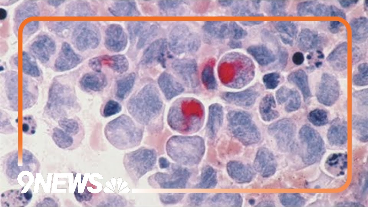 New study says traces of ancient viruses are in our DNA may play a role ...