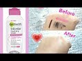 New garnier Micellar water or Makeup remover Honest review +LiveDemo in Urdu|Hindi