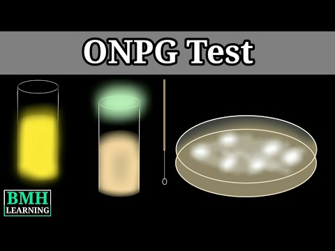 ONPG Test | Beta-galactosidase ONPG Activity Assay |