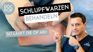 OP Video!!! SCHLUPFWARZEN BEHANDELN – Dr. Rolf Bartsch