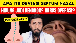 Deviated Nasal Septum: What Causes It? Is Surgery Necessary?