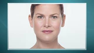 Kybella Reel Music 120718