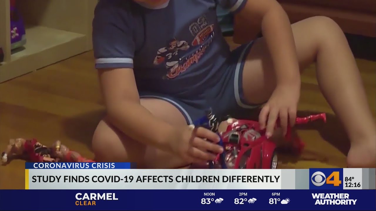 Study shows COVID-19 affects children differently