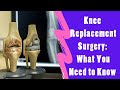 Knee Replacement Surgery | what You Need To Know | Dr. Akhila Sunder | Hyderabad