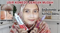 Cara Menghilangkan Komedo Dengan Cepat dan Mudah Menggunakan Pastagigi - Durasi: 10.02. 