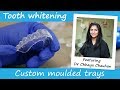 Dentist made teeth whitening trays explained