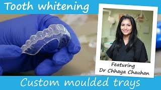 Dentist made teeth whitening trays explained