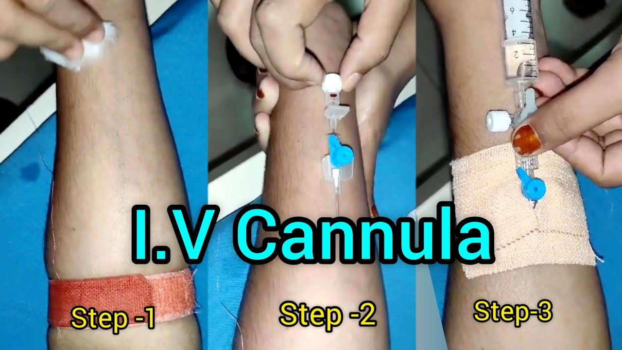 IV Cannulation Step by Step kaise lagaye ? Veinflow kaise lagaye? iv ...