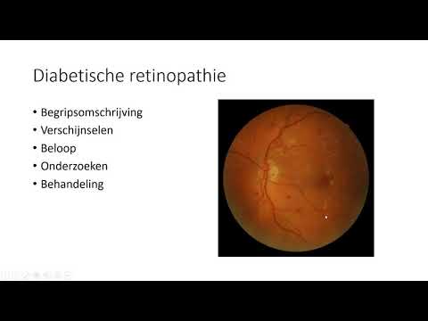 Video: Optische Coherentie Tomografie Angiografie In Diabetische Retinopathie: Een Overzicht Van Huidige Toepassingen