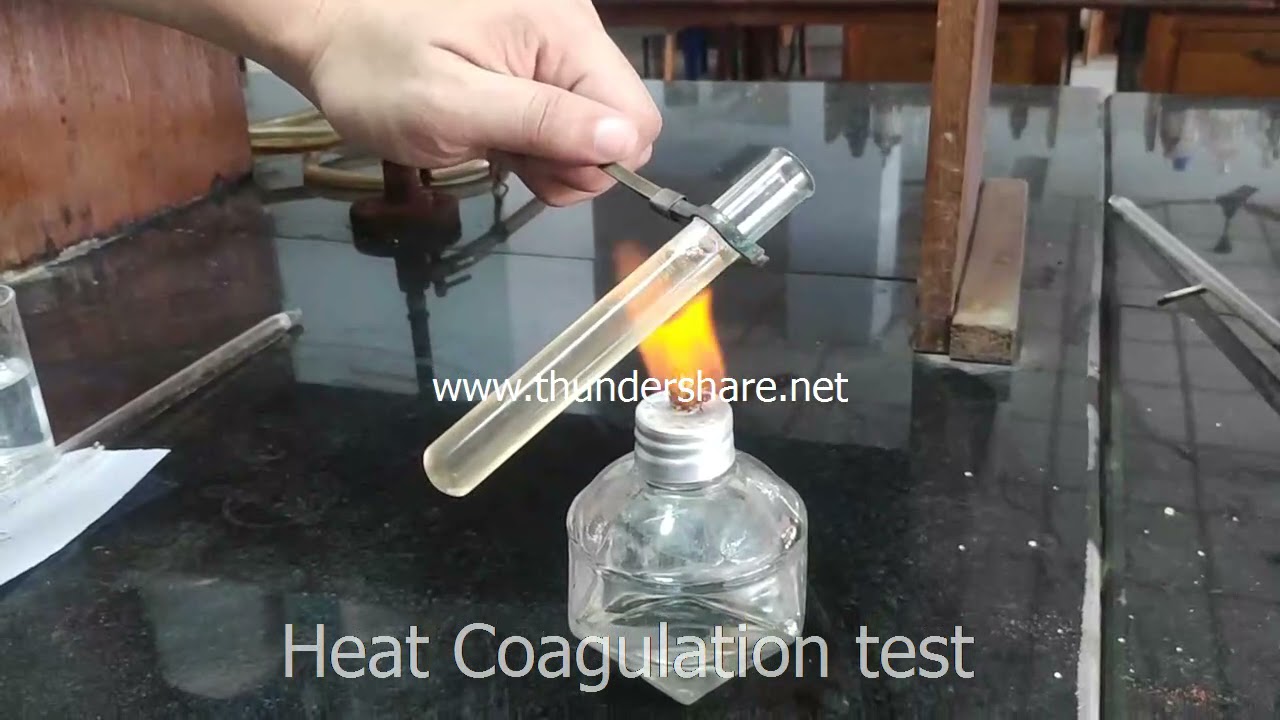 Analysis of Abnormal Constituents of urine