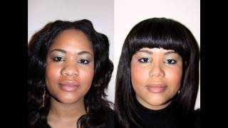 African American Female Rhinoplasty NYC Before & After Dr. Sam Rizk