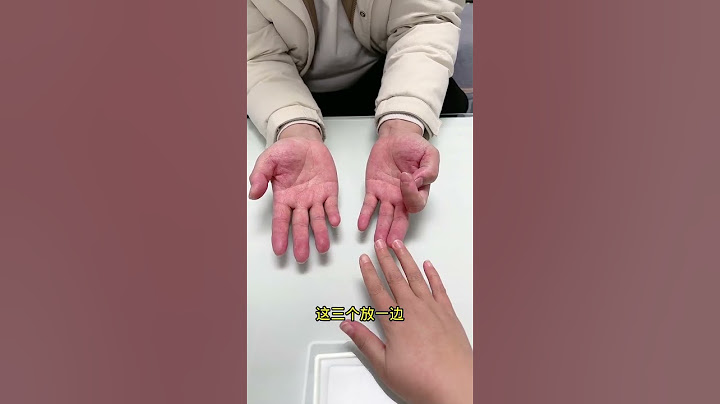 怎么证明你有11根手指？ #一键入戏