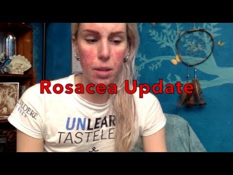 Treating "Rosacea" Update