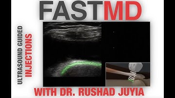 Dr. Rushad Juyia: Ultrasound guided injections