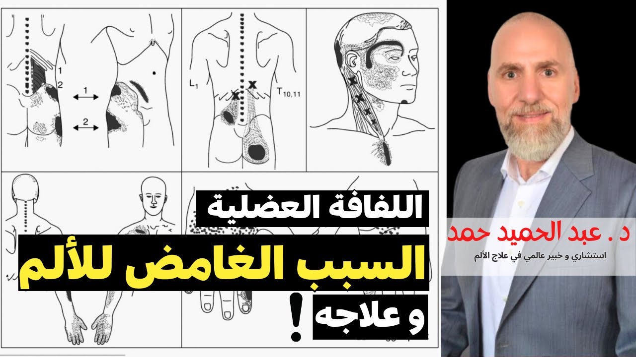 حير الجميع ويؤدي لجراحة غير ضرورية! 5 خرافات🤯حول # ألم اللفافة العضلية: #دكتور _عبد_الحميد_حمد