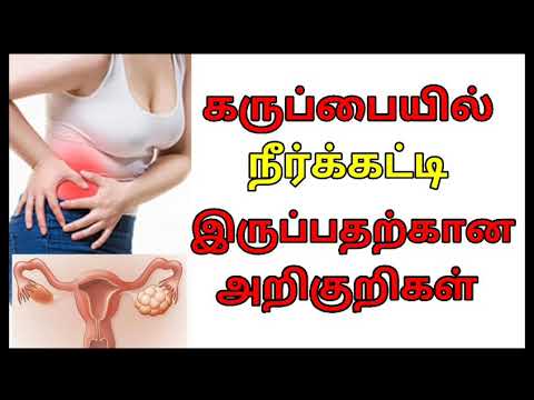 கருப்பையில் நீர்க்கட்டி இருப்பதற்கான அறிகுறிகள் | Neerkatti Symptoms | PCOD,PCOS Symptoms in Tamil.