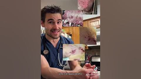 Immune Mediated Thrombocytopenia (ITP or IMT)