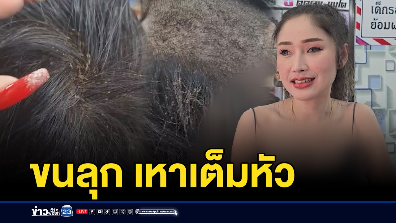 ด.ญ.มีเหานับปี ปักหนังหัวสุดทรมาน l ตลาดข่าว - ข่าวเช้าเวิร์คพอยท์ l 17 ก.ย.67