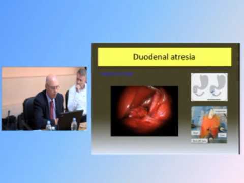 ESPES/IPEG 2nd Masterclass - Laparoscopic Treatment of Duodenal Atresia Prof. F. Varlet