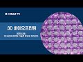 3D 바이오프린팅을 통한 NK세포의 암세포 제거