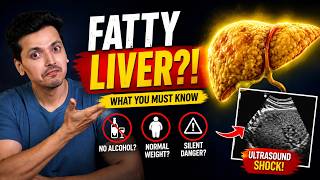 Fatty Liver: Symptoms, Causes & How to Reverse It Naturally | Complete Guide