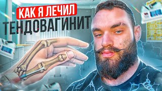 ТЕНДОВАГИНИТ ( БОЛЕЗНЬ ДЕ КЕРВЕНА ) : Методы лечения