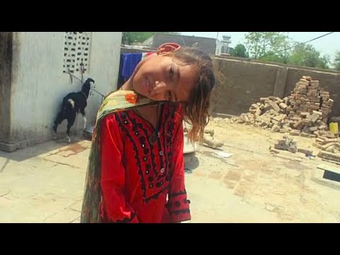 Видео: Эта девочка 12 лет жила с согнутой под 90 градусов шеей. История Афшин Гюл