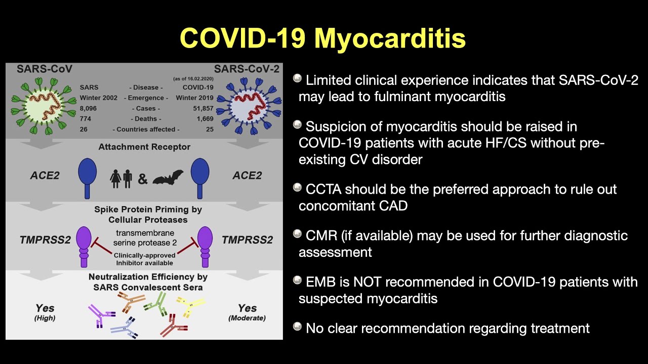 Cardiogenic shock Part 4 Myocarditis 2:2