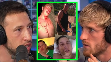 MIKE DESCRIBES MOST GRUESOME INJURIES EVER ENDURED